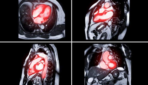 Cardiac MRI Interpretations And Reading Services Provided By The National Diagnostic Imaging Teleradiology Company - October 27 2022 - Cleveland Ohio