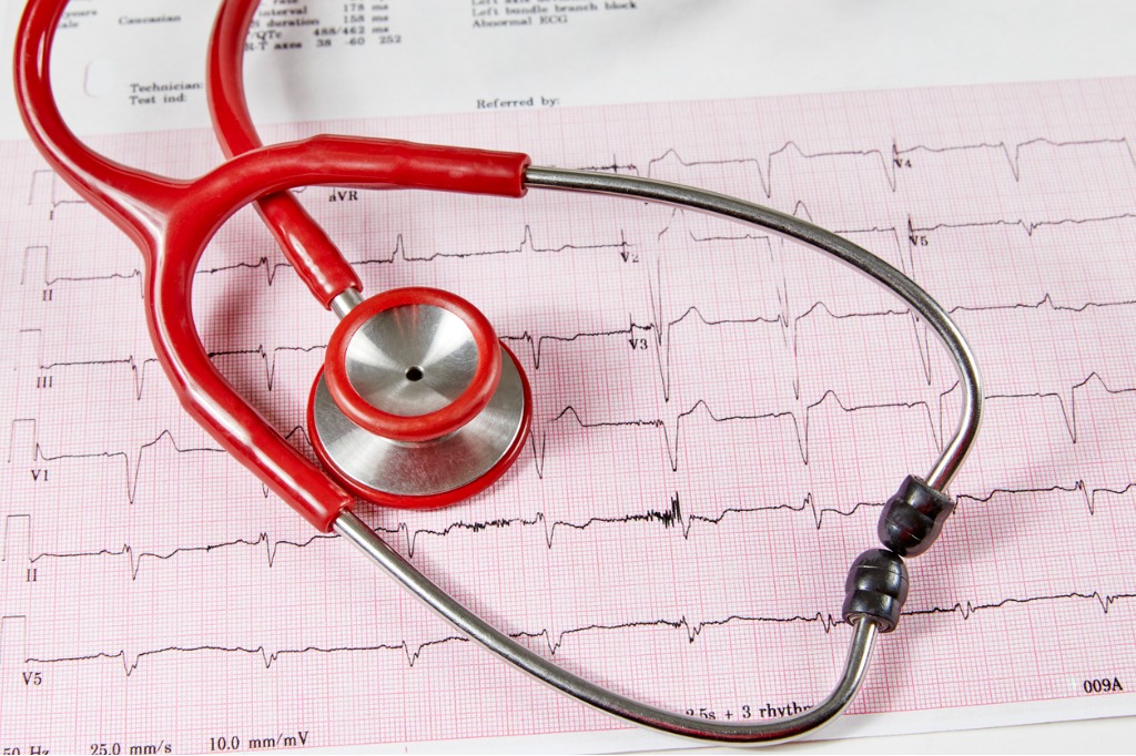 Electrocardiography (ECG) is a useful diagnostic tool in the diagnosis and management of ischemic heart disease and cardiac arrhythmia and its availability in the primary care setting is now common.