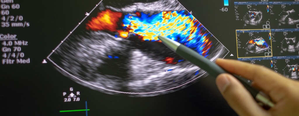 There are several types of echocardiography (echo)—all use sound waves to create pictures of your heart. This is the same technology that allows doctors to see an unborn baby inside a pregnant woman. Unlike x-rays and some other tests, echo doesn't involve radiation.