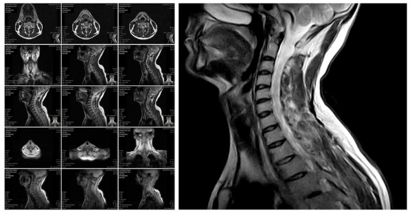 May 4 2022 - MRI readings from National Diagnostic Imaging and reliable reporting services for MRI interpretations