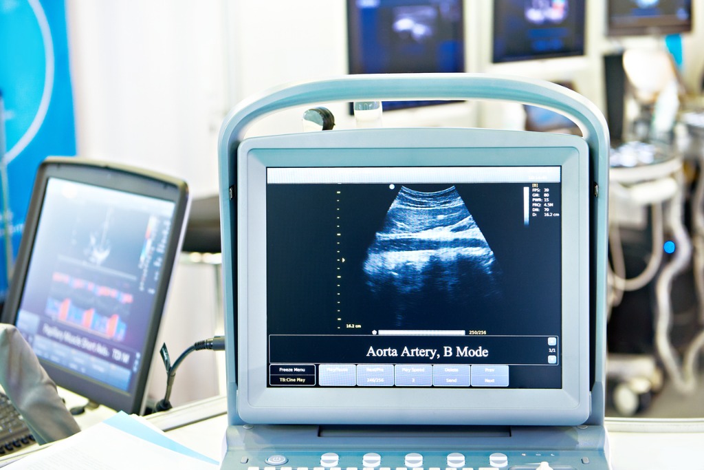 NDI US board certified radiologists read and interpret ultrasound tests for  portable mobile ultrasound services and accredited mobile ultrasound service for medical practices.