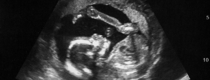 Ultrasound Scans In Pregnancy - National Diagnostic Imaging Teleradiology Company - November 4 2022 - Cleveland Ohio
